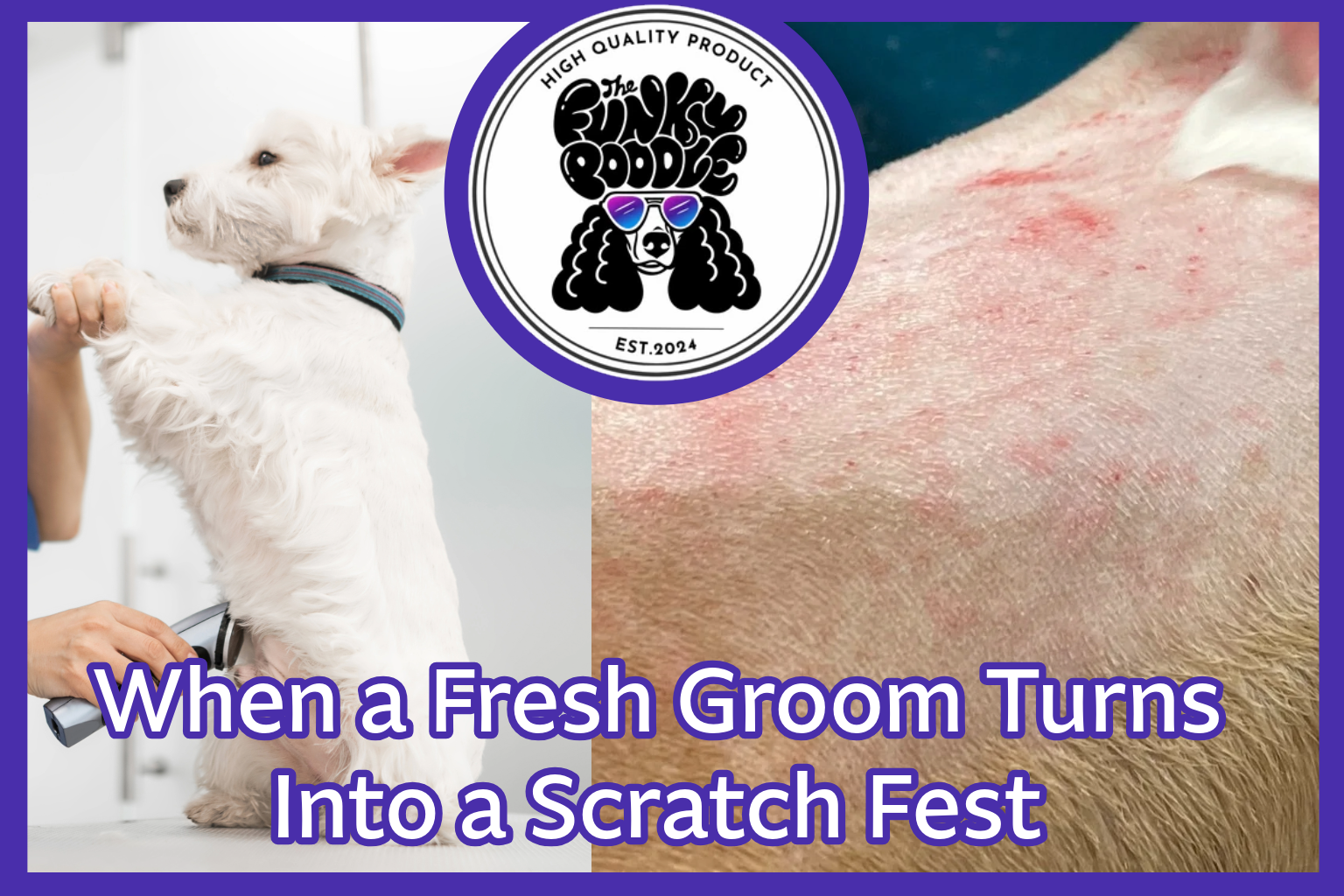Why Post Groom Rash is the Worst and How to Treat It